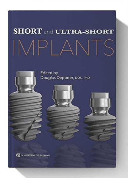 Short and Ultra-Short Implants 1st Edition