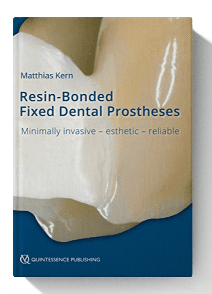 Resin-Bonded Fixed Dental Prostheses: Minimally invasive - esthetic - reliable 1st Edition