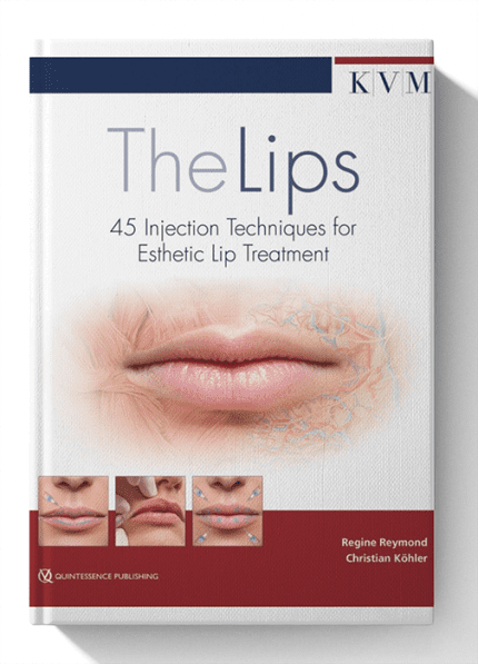 The Lips: 45 Injection Techniques for Esthetic Lip Treatment 1st Edition (Scanned)