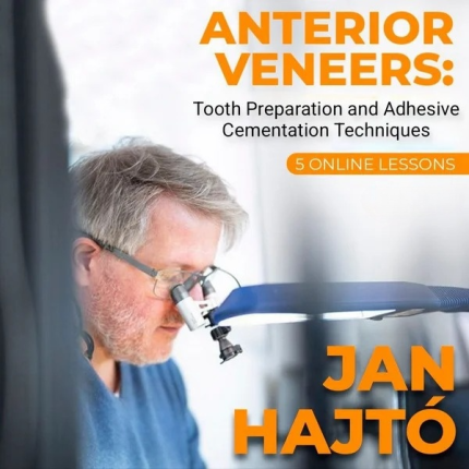 Anterior Veneer: Tooth Preparation and Adhesive Cementation Techniques