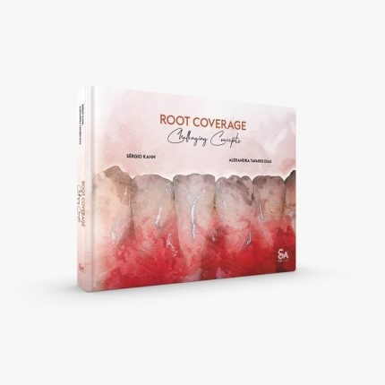 Root Coverage – Challenging Concepts