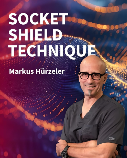 Socket Shield Technique