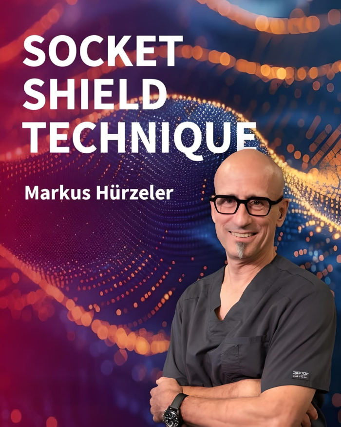 Socket Shield Technique